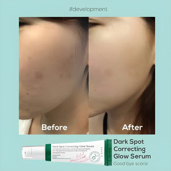 100% Original Buy AXIS-Y, Dark Spot Correcting Glow Serum